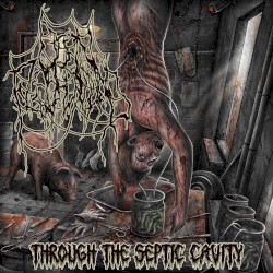 Through the Septic Cavity