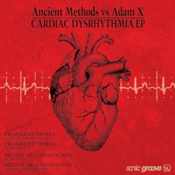 Cardiac Dysrhythmia EP