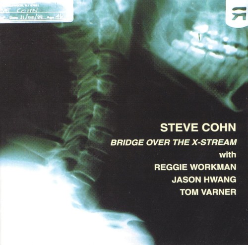 Bridge Over the X-Stream