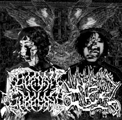 bottom surgery / VULGAR