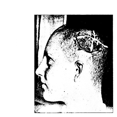 Bedsores / Pink Thistle